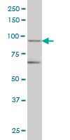 TRIM36 Antibody - TRIM36 monoclonal antibody (M01), clone 2D11 Western blot of TRIM36 expression in IMR-32.