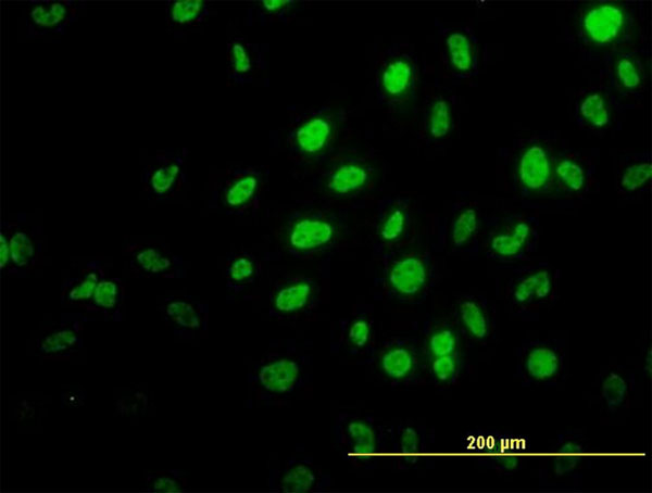 TRIM36 Antibody - Immunofluorescence of monoclonal antibody to TRIM36 on HeLa cell. [antibody concentration 10 ug/ml]