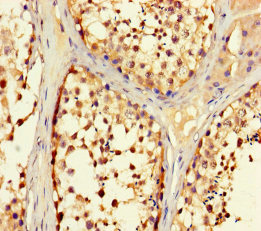 TRIM36 Antibody - Immunohistochemistry of paraffin-embedded human testis tissue using TRIM36 Antibody at dilution of 1:100