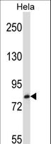 TRIM37 / TEF3 Antibody - TRIM37 Antibody western blot of HeLa cell line lysates (35 ug/lane). The TRIM37 antibody detected the TRIM37 protein (arrow).