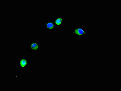 TRIM37 / TEF3 Antibody - Immunofluorescent analysis of Hela cells using TRIM37 Antibody at dilution of 1:100 and Alexa Fluor 488-congugated AffiniPure Goat Anti-Rabbit IgG(H+L)