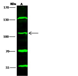TRIM37 / TEF3 Antibody - Anti-TRIM37 rabbit polyclonal antibody at 1:500 dilution. Lane A: Raji Whole Cell Lysate. Lysates/proteins at 30 ug per lane. Secondary: Goat Anti-Rabbit IgG H&L (Dylight800) at 1/10000 dilution. Developed using the Odyssey technique. Performed under reducing conditions. Predicted band size: 108 kDa. Observed band size: 108 kDa. (We are unsure as to the identity of these extra bands.)