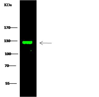 TRIM37 / TEF3 Antibody - Anti-TRIM37 rabbit polyclonal antibody at 1:500 dilution. Lane A: Raji Whole Cell Lysate. Lysates/proteins at 30 ug per lane. Secondary: Goat Anti-Rabbit IgG H&L (Dylight 800) at 1/10000 dilution. Developed using the Odyssey technique. Performed under reducing conditions. Predicted band size: 108 kDa. Observed band size: 128 kDa.