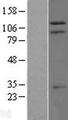 TRIM37 / TEF3 Protein - Western validation with an anti-DDK antibody * L: Control HEK293 lysate R: Over-expression lysate