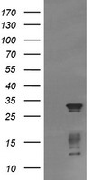 TRIM38 Antibody - E.coli lysate (5 ug, left lane) and E.coli lysate expressing human recombinant protein fragment (5 ug, right lane) corresponding to amino acids 1-265 of human TRIM38(NP_006346) were separated by SDS-PAGE and immunoblotted with anti-TRIM38.