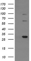 TRIM38 Antibody - Negative control HEK293T lysate (Left lane) or HEK293T lysate containing recombinant protein fragment for human TRIM38 (NP_006346) gene (amino acids 1-265) (Right lane). Equivalent amounts (5 ug per lane) were separated by SDS-PAGE and then immunoblotted with anti-TRIM38. .