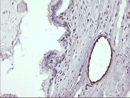 TRIM38 Antibody - IHC of paraffin-embedded Human prostate tissue using anti-TRIM38 mouse monoclonal antibody.