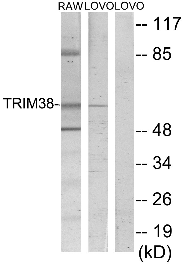 TRIM38 Antibody - Western blot analysis of lysates from LOVO and RAW264.7 cells, using TRIM38 Antibody. The lane on the right is blocked with the synthesized peptide.