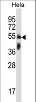 TRIM38 Antibody - TRIM38 Antibody western blot of HeLa cell line lysates (35 ug/lane). The TRIM38 antibody detected the TRIM38 protein (arrow).