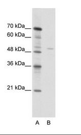 TRIM38 Antibody - A: Marker, B: Jurkat Cell Lysate.  This image was taken for the unconjugated form of this product. Other forms have not been tested.