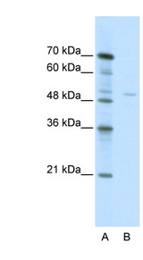 TRIM38 Antibody - TRIM38 antibody Western blot of Jurkat lysate. This image was taken for the unconjugated form of this product. Other forms have not been tested.