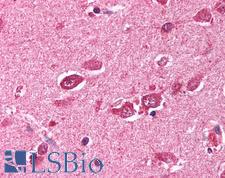 TRIM38 Antibody - Anti-TRIM38 antibody IHC of human brain, cortex. Immunohistochemistry of formalin-fixed, paraffin-embedded tissue after heat-induced antigen retrieval. Antibody concentration 5 ug/ml.  This image was taken for the unconjugated form of this product. Other forms have not been tested.