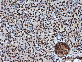 TRIM38 Antibody - IHC of paraffin-embedded Human pancreas tissue using anti-TRIM38 mouse monoclonal antibody.