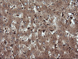 TRIM38 Antibody - IHC of paraffin-embedded Human liver tissue using anti-TRIM38 mouse monoclonal antibody.
