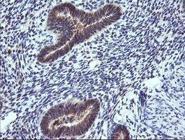 TRIM38 Antibody - IHC of paraffin-embedded Human endometrium tissue using anti-TRIM38 mouse monoclonal antibody.