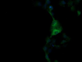 TRIM38 Antibody - Anti-TRIM38 mouse monoclonal antibody immunofluorescent staining of COS7 cells transiently transfected by pCMV6-ENTRY TRIM38.