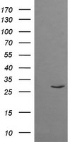 TRIM38 Antibody - Negative control HEK293T lysate (Left lane) or HEK293T lysate containing recombinant protein fragment for human TRIM38 (NP_006346) gene (amino acids 1-265) (Right lane). Equivalent amounts (5 ug per lane) were separated by SDS-PAGE and then immunoblotted with anti-TRIM38. .
