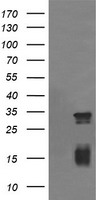 TRIM38 Antibody - E.coli lysate (5 ug, left lane) and E.coli lysate expressing human recombinant protein fragment (5 ug, right lane) corresponding to amino acids 288-580 of human TRIM38 (NP_006346) were separated by SDS-PAGE and immunoblotted with anti-TRIM38.