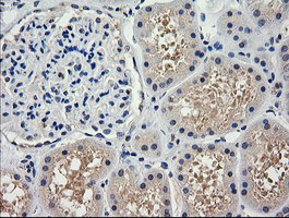 TRIM38 Antibody - IHC of paraffin-embedded Human Kidney tissue using anti-TRIM38 mouse monoclonal antibody.