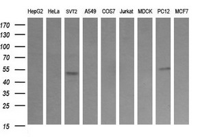 TRIM38 Antibody - Western blot of extracts (35 ug) from 9 different cell lines by using anti-TRIM38 monoclonal antibody (HepG2: human; HeLa: human; SVT2: mouse; A549: human; COS7: monkey; Jurkat: human; MDCK: canine; PC12: rat; MCF7: human).