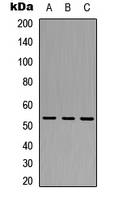 TRIM38 Antibody - Western blot analysis of TRIM38 expression in HeLa (A); A549 (B); Raw264.7 (C) whole cell lysates.