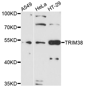 TRIM38 Antibody - Western blot analysis of extracts of various cells.