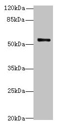 TRIM38 Antibody - Western blot All lanes: TRIM38 antibody at 4µg/ml Lane 1: 293T whole cell lysate Lane 2: Hela whole cell lysate Lane 3: Jurkat whole cell lysate Lane 4: HepG2 whole cell lysate Secondary Goat polyclonal to rabbit IgG at 1/10000 dilution Predicted band size: 53 kDa Observed band size: 53 kDa