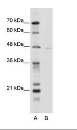 TRIM38 Antibody - A: Marker, B: HepG2 Cell Lysate.  This image was taken for the unconjugated form of this product. Other forms have not been tested.