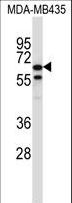 TRIM39 / RNF23 Antibody - TRIM39 Antibody western blot of MDA-MB435 cell line lysates (35 ug/lane). The TRIM39 antibody detected the TRIM39 protein (arrow).
