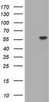 TRIM39 / RNF23 Antibody - HEK293T cells were transfected with the pCMV6-ENTRY control (Left lane) or pCMV6-ENTRY TRIM39 (Right lane) cDNA for 48 hrs and lysed. Equivalent amounts of cell lysates (5 ug per lane) were separated by SDS-PAGE and immunoblotted with anti-TRIM39.