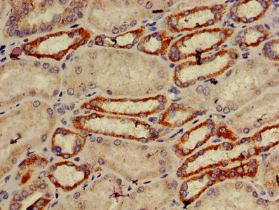 TRIM39 / RNF23 Antibody - IHC image of TRIM39 Antibody diluted at 1:600 and staining in paraffin-embedded human kidney tissue performed on a Leica BondTM system. After dewaxing and hydration, antigen retrieval was mediated by high pressure in a citrate buffer (pH 6.0). Section was blocked with 10% normal goat serum 30min at RT. Then primary antibody (1% BSA) was incubated at 4°C overnight. The primary is detected by a biotinylated secondary antibody and visualized using an HRP conjugated SP system.