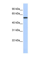 TRIM4 / RNF87 Antibody - TRIM4 / RNF87 antibody Western blot of Fetal Brain lysate. This image was taken for the unconjugated form of this product. Other forms have not been tested.