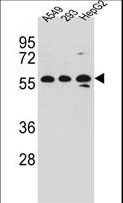 TRIM4 / RNF87 Antibody - TRIM4 Antibody western blot of A549,293,HepG2 cell line lysates (35 ug/lane). The TRIM4 antibody detected the TRIM4 protein (arrow).