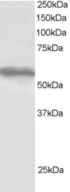 TRIM4 / RNF87 Antibody - Antibody staining (1 ug/ml) of HepG2 lysate (RIPA buffer, 30 ug total protein per lane). Primary incubated for 1 hour. Detected by Western blot of chemiluminescence.