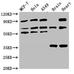 TRIM4 / RNF87 Antibody - Positive WB detected in:MCF-7 whole cell lysate,Hela whole cell lysate,A549 whole cell lysate,Rat brain tissue,Rat heart tissue;All lanes:TRIM4 antibody at 3.4?g/ml;Secondary;Goat polyclonal to rabbit IgG at 1/50000 dilution;Predicted band size: 58,55,35 KDa;Observed band size: 55,62,35,90 KDa;