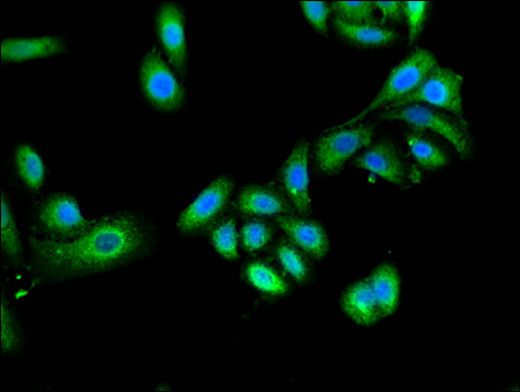TRIM4 / RNF87 Antibody - Immunofluorescent analysis of HepG2 cells using TRIM4 Antibody at a dilution of 1:100 and Alexa Fluor 488-congugated AffiniPure Goat Anti-Rabbit IgG(H+L)