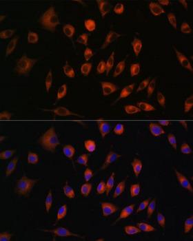 TRIM4 / RNF87 Antibody - Immunofluorescence analysis of L929 cells using TRIM4 Polyclonal Antibody at dilution of 1:100.Blue: DAPI for nuclear staining.