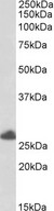 TRIM40 Antibody - Goat Anti-RNF35 / TRIM40 Antibody (0.5µg/ml) staining of Human Placenta lysate (35µg protein in RIPA buffer). Primary incubation was 1 hour. Detected by chemiluminescencence.