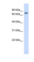 TRIM41 Antibody - TRIM41 antibody Western blot of Fetal Muscle lysate. This image was taken for the unconjugated form of this product. Other forms have not been tested.