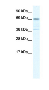TRIM41 Antibody - TRIM41 antibody TRIM41 (tripartite motif-containing 41) Antibody Western Blot analysis of Fetal liver lysate.  This image was taken for the unconjugated form of this product. Other forms have not been tested.