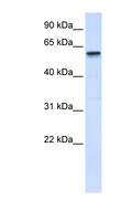 TRIM41 Antibody - TRIM41 antibody Western blot of Placenta lysate. This image was taken for the unconjugated form of this product. Other forms have not been tested.