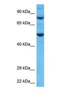 TRIM41 Antibody - Western blot of TRI41 Antibody with human HepG2 Whole Cell lysate.  This image was taken for the unconjugated form of this product. Other forms have not been tested.