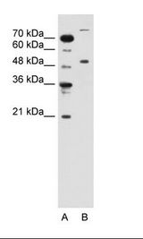TRIM42 Antibody - A: Marker, B: Jurkat Cell Lysate.  This image was taken for the unconjugated form of this product. Other forms have not been tested.