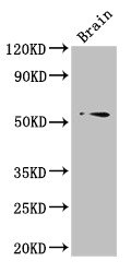 TRIM43 Antibody - Western Blot Positive WB detected in: Mouse brain tissue All lanes: TRIM43 antibody at 3µg/ml Secondary Goat polyclonal to rabbit IgG at 1/50000 dilution Predicted band size: 53 kDa Observed band size: 53 kDa