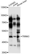 TRIM43 Antibody - Western blot analysis of extracts of various cell lines, using TRIM43 antibody at 1:1000 dilution. The secondary antibody used was an HRP Goat Anti-Rabbit IgG (H+L) at 1:10000 dilution. Lysates were loaded 25ug per lane and 3% nonfat dry milk in TBST was used for blocking. An ECL Kit was used for detection and the exposure time was 30s.