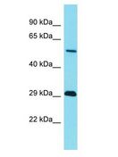 TRIM43B Antibody - TRIM43B antibody Western Blot of Fetal Heart. Antibody dilution: 1 ug/ml.  This image was taken for the unconjugated form of this product. Other forms have not been tested.