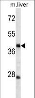 TRIM44 Antibody - TRIM44 Antibody western blot of mouse liver tissue lysates (35 ug/lane). The TRIM44 Antibody detected the TRIM44 protein (arrow).
