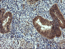 TRIM44 Antibody - IHC of paraffin-embedded Human endometrium tissue using anti-TRIM44 mouse monoclonal antibody.