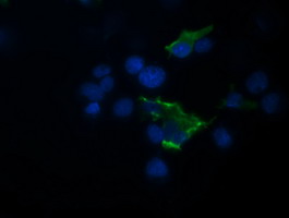 TRIM44 Antibody - Anti-TRIM44 mouse monoclonal antibody immunofluorescent staining of COS7 cells transiently transfected by pCMV6-ENTRY TRIM44.