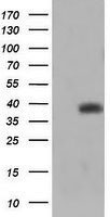 TRIM44 Antibody - HEK293T cells were transfected with the pCMV6-ENTRY control (Left lane) or pCMV6-ENTRY TRIM44 (Right lane) cDNA for 48 hrs and lysed. Equivalent amounts of cell lysates (5 ug per lane) were separated by SDS-PAGE and immunoblotted with anti-TRIM44.